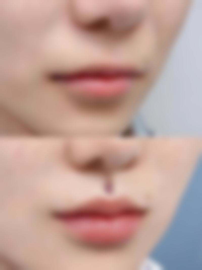 刘晨涛在哪家医院