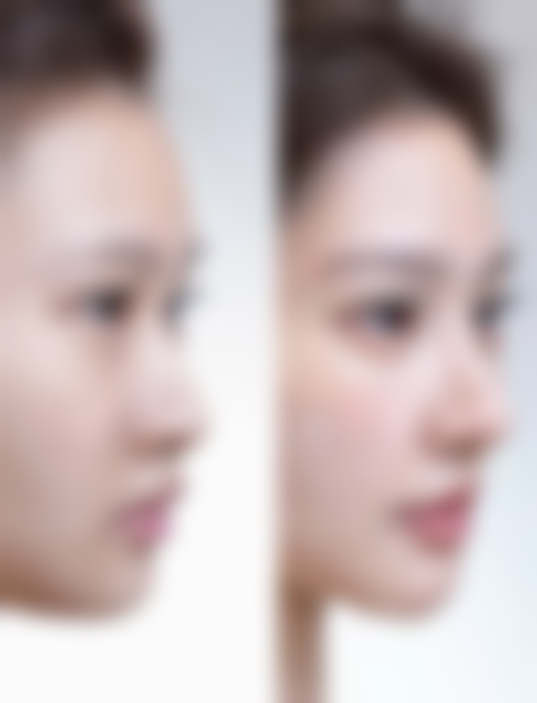 周林英皮肤美容实例