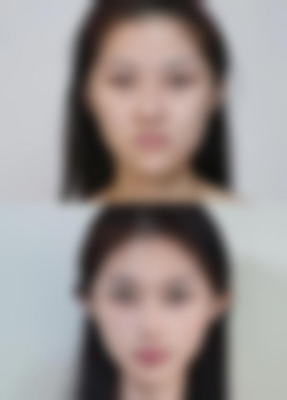 七、扬州第一人民医院整形美容科价格表:(仅供参考)