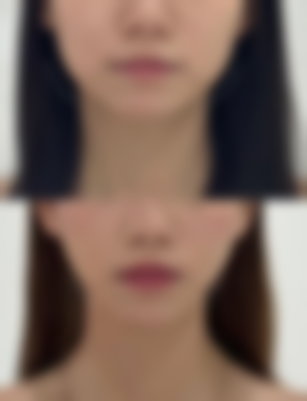 七、新都卓美色医疗美容价格表:(仅供参考)