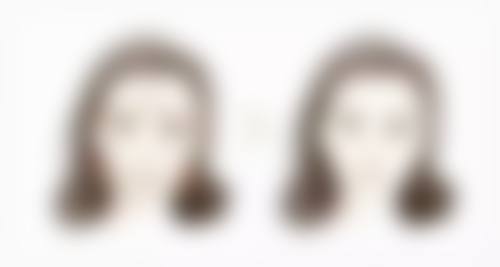 隆鼻后碰到鼻子会怎样?美学风险要关注