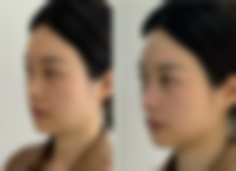 七、长沙如美(艾缇)医疗美容门诊部真实的顾客评价如下: