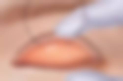 四、梅州半岛整形医院开展的主要项目和特色项目：