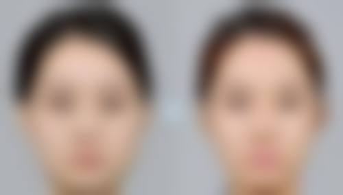 五、宁波珈禾整形医院实例