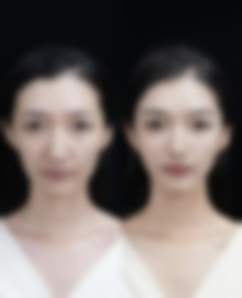 五、成都蜀尚蓉雅美容整形医院实例