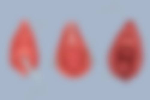 三、钦州挚妍整形医院基本信息：