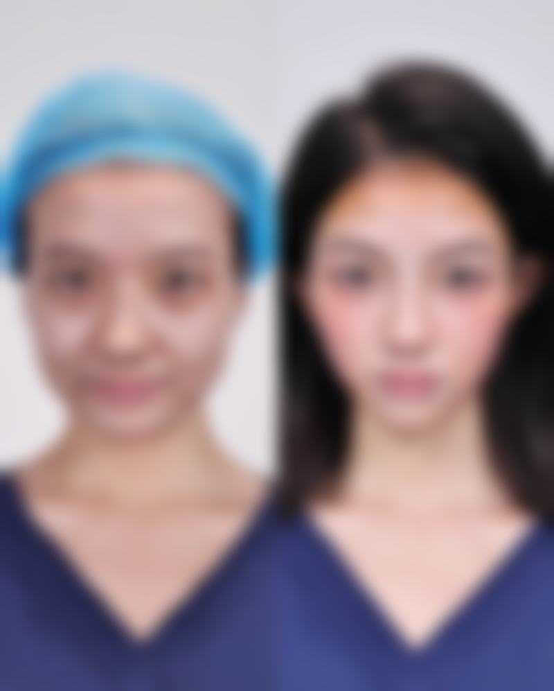 五、黄山歙县人民医院怎么预约：