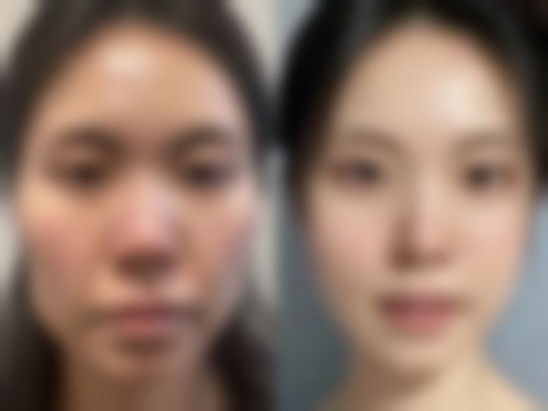 七、沈阳凯尔亿美医疗美容诊所真实的顾客评价如下：