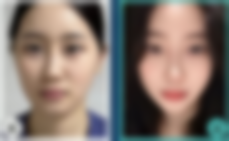 六、钦州挚妍整形医院怎么预约：