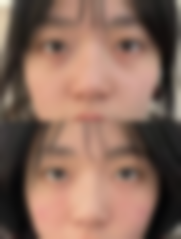 董子瑄口腔颌面整形水平怎么样可靠吗？