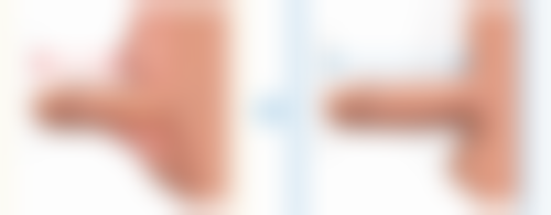 六、开封汴美整形医院价格表：（仅供参考）