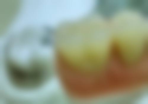 {海口爱牙口腔医院矫正牙齿效果咋样？先进技术与贴心服务让牙齿整齐又美观 