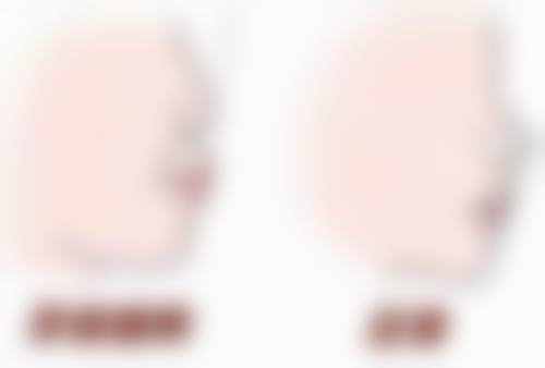 海口爱牙口腔医院矫正牙齿成效咋样？价格合理口碑好