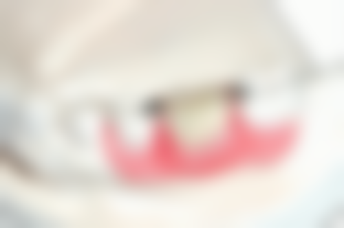 海口爱牙口腔医院矫正牙齿成效咋样？医生技术特别靠谱