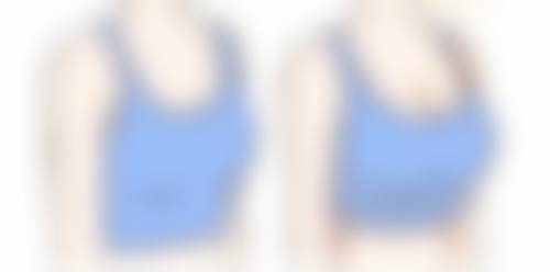 重视疤痕稳定：二次修复的关键条件