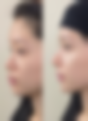 二、武汉悦辰医疗美容门诊部正规吗？来看看医院资质：