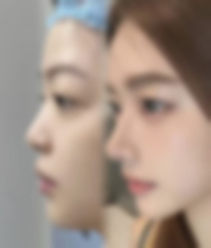 七、杭州美佳美医疗美容门诊部价格表：（仅供参考）