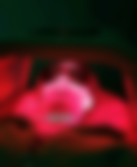 反复长痘星人亲测！深圳米兰柏羽水杨酸红蓝光祛痘398元 半个月没复发