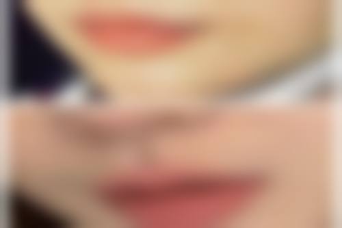 四、青岛芳子医疗美容诊所实例