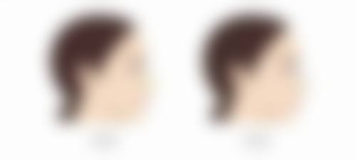 四、hannacell皮肤科实例