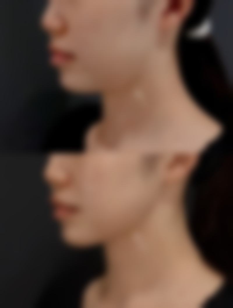 六、hannacell皮肤科价格表：（仅供参考）