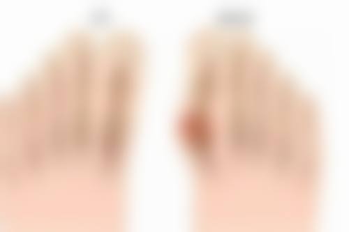 隆鼻取耳软骨优势多？自身组织融合佳，塑造自然鼻尖效果超持久 