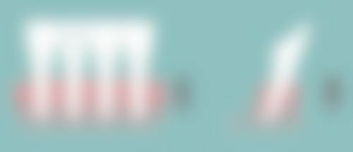 隆鼻取耳软骨，成效持久稳定