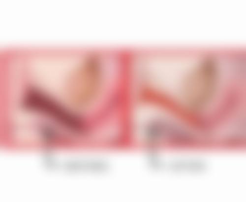 阿尔法、贝塞尔双眼皮等与全切双眼皮，修复期差异大比拼