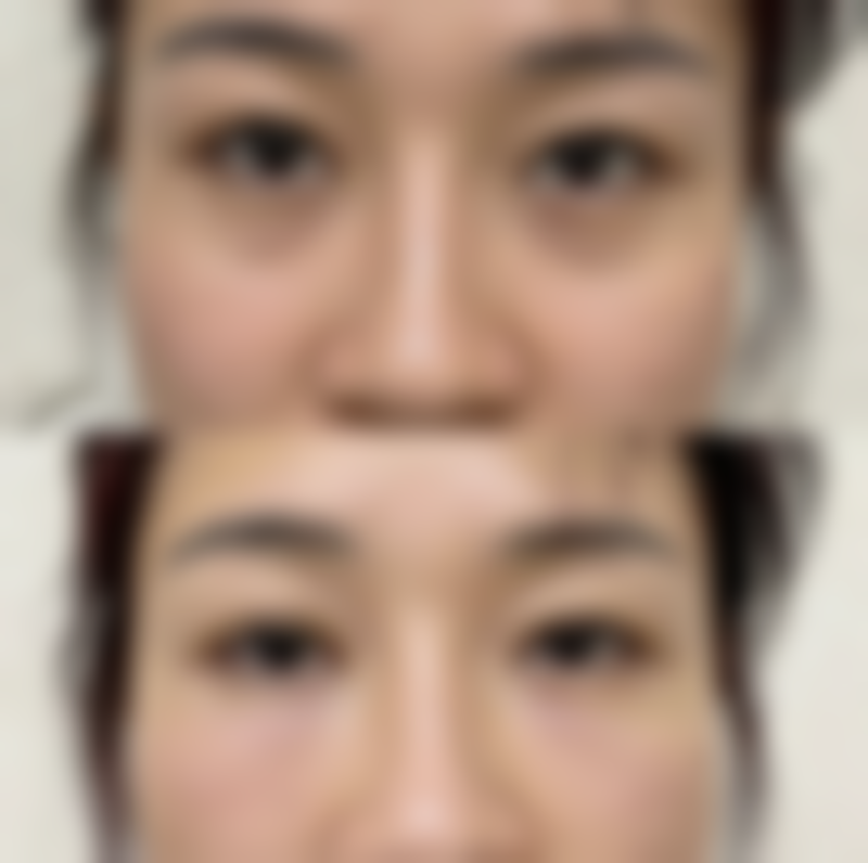 六、海口韩漾整形医院怎么预约：