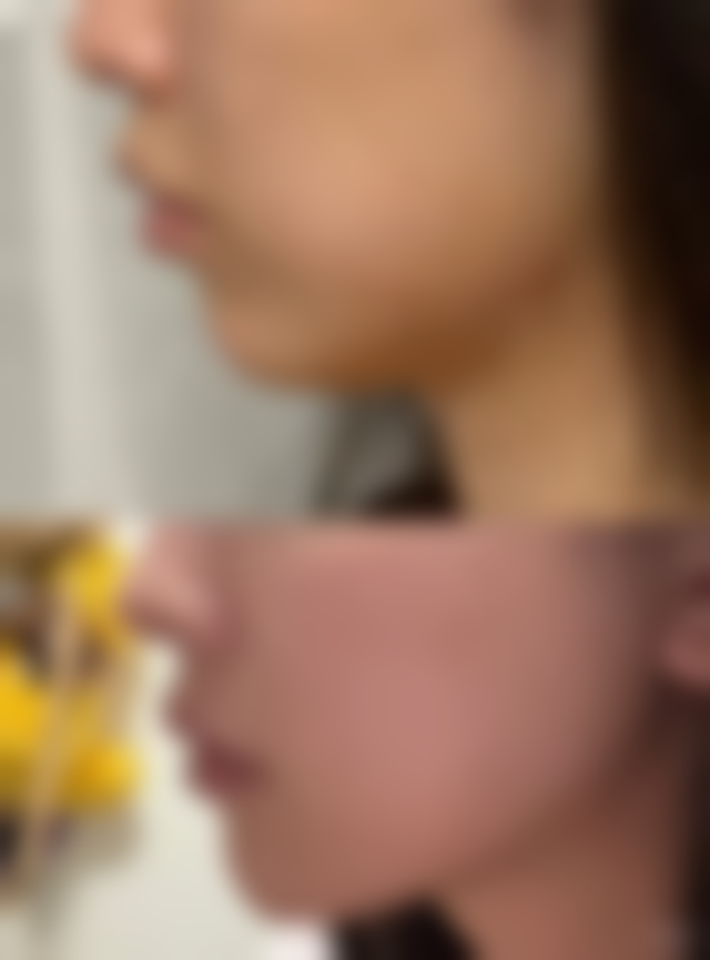 五、贵州厘子美学医疗整形美容诊所实例