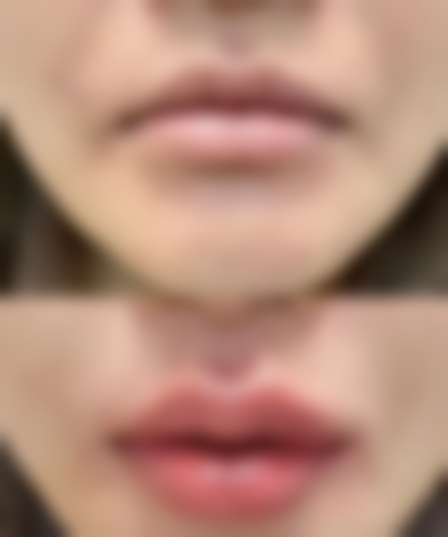 医院专精助力的重要性