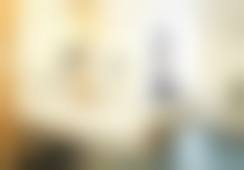 周亚超眼部整形医生实例