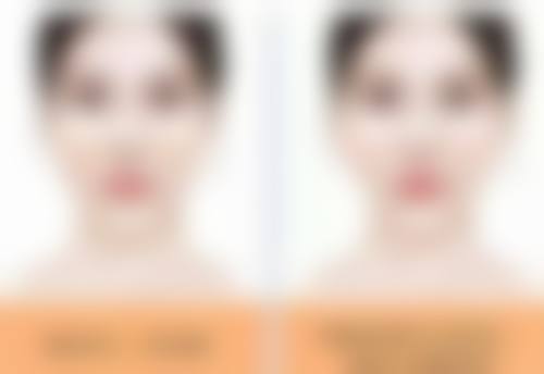 六、深圳一凡整形医院怎么预约：