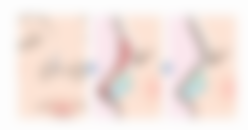 四、鄂尔多斯市王全胜医疗美容诊所实例