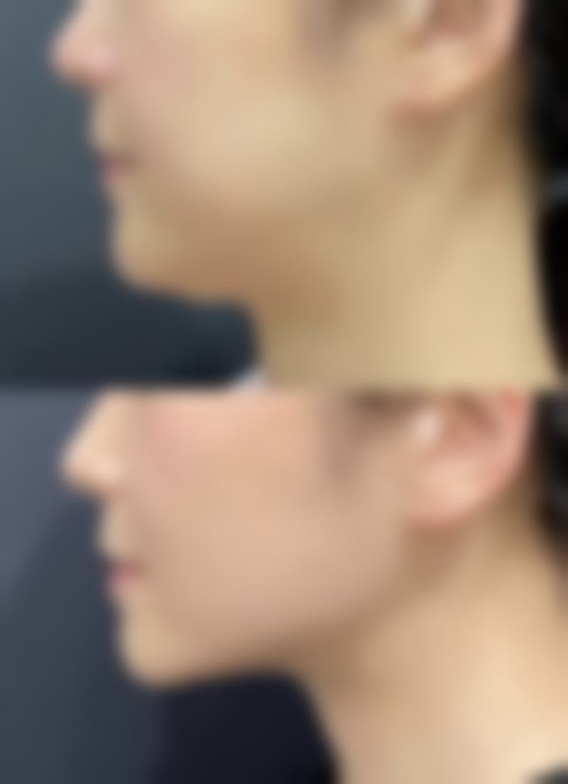 四、咸阳华艺天姿医疗美容医院实例