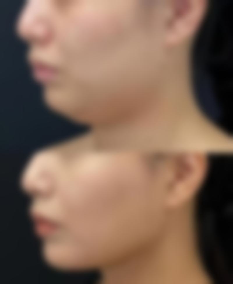 六、德阳东美奥拉克医疗美容整形医院价格表：（仅供参考）