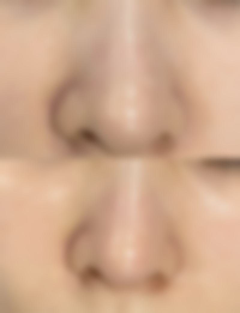 五、宋秀娥医生A5C中医针灸学技术实例分析