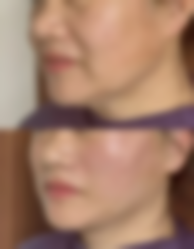 五、德阳东美奥拉克医疗美容整形医院怎么预约：