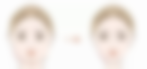 七、临沂丽人医院整形美容中 心价格表：（仅供参考）