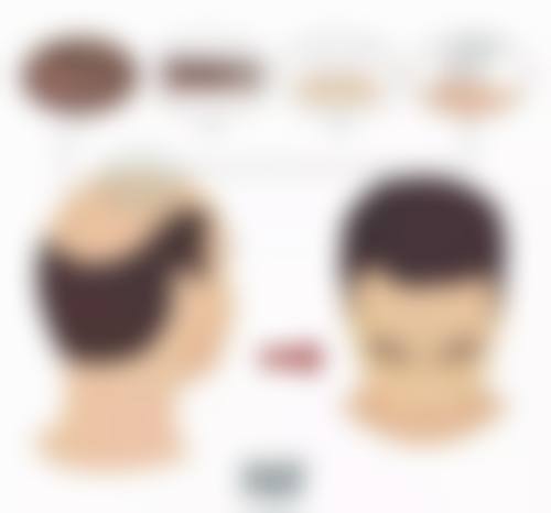 白色疤痕淡化：日常护理不可少