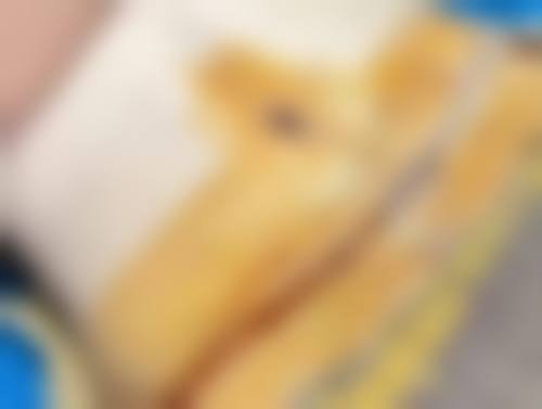 白色疤痕淡化：微针治疗促修复