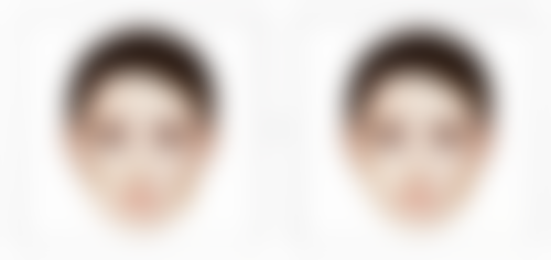 四、香河惠熙整形医院实例