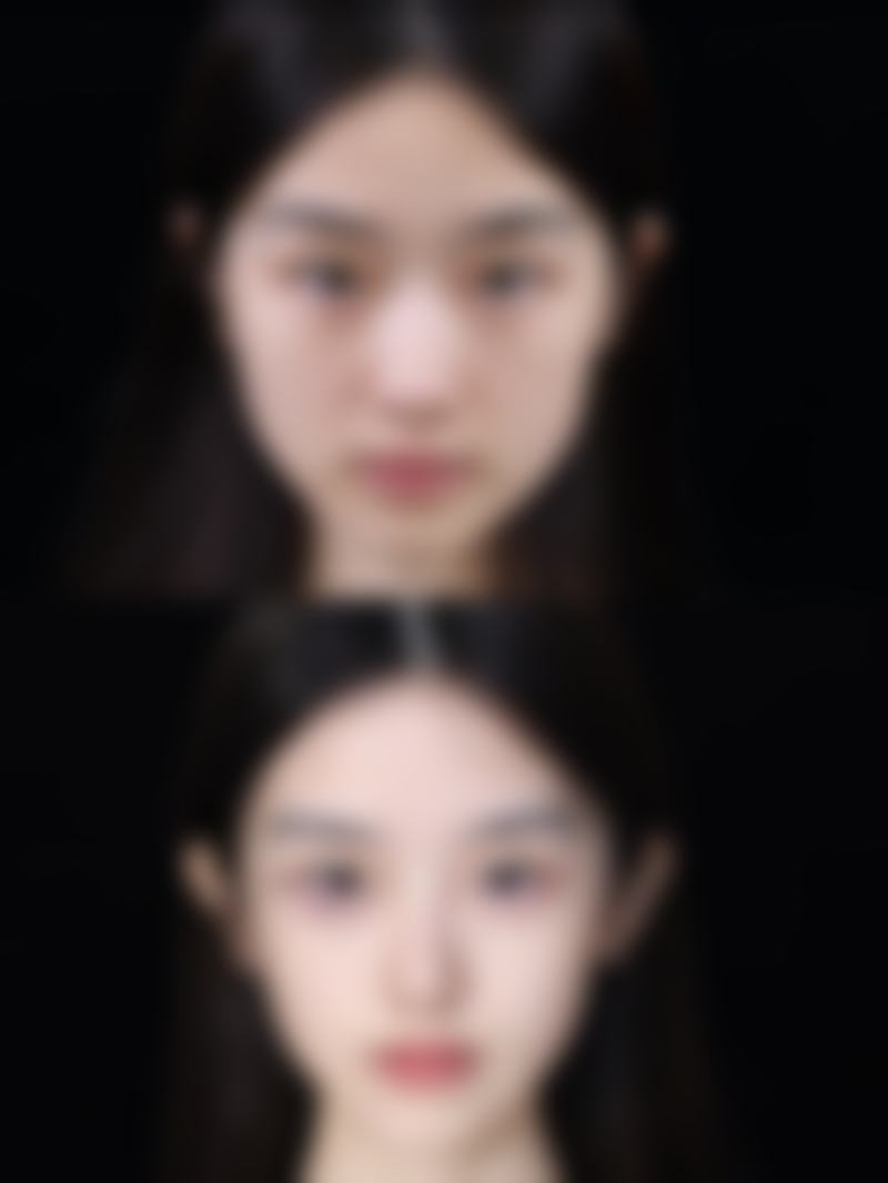 五、昆明美立方医疗美容医院实例