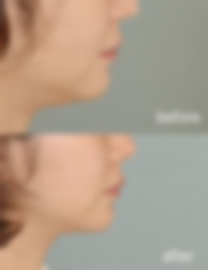 八、厦门宾小美整形医院真实的顾客评价如下：