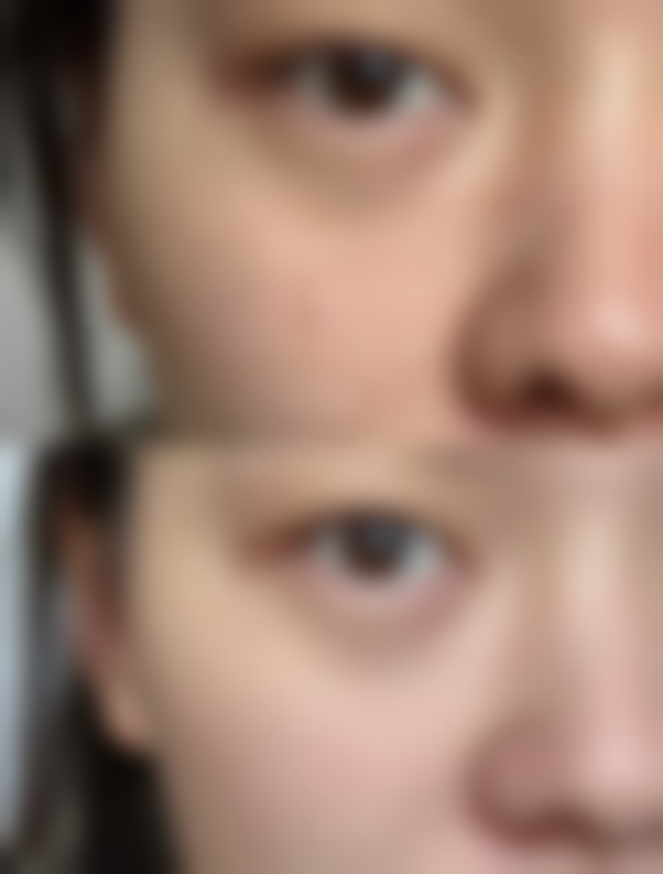 六、香河惠熙整形医院价格表：（仅供参考）