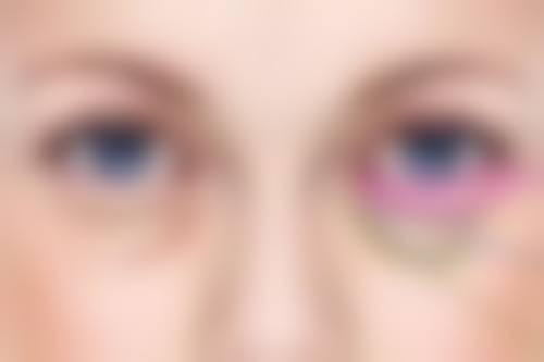 疤克使用：正确方法让成效事半功倍