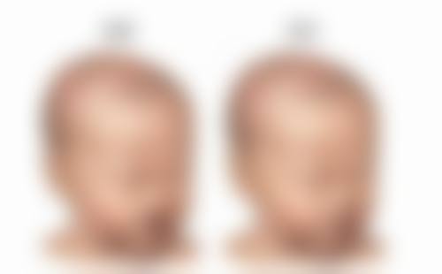 如何快速告别眼袋？生活习惯要改善