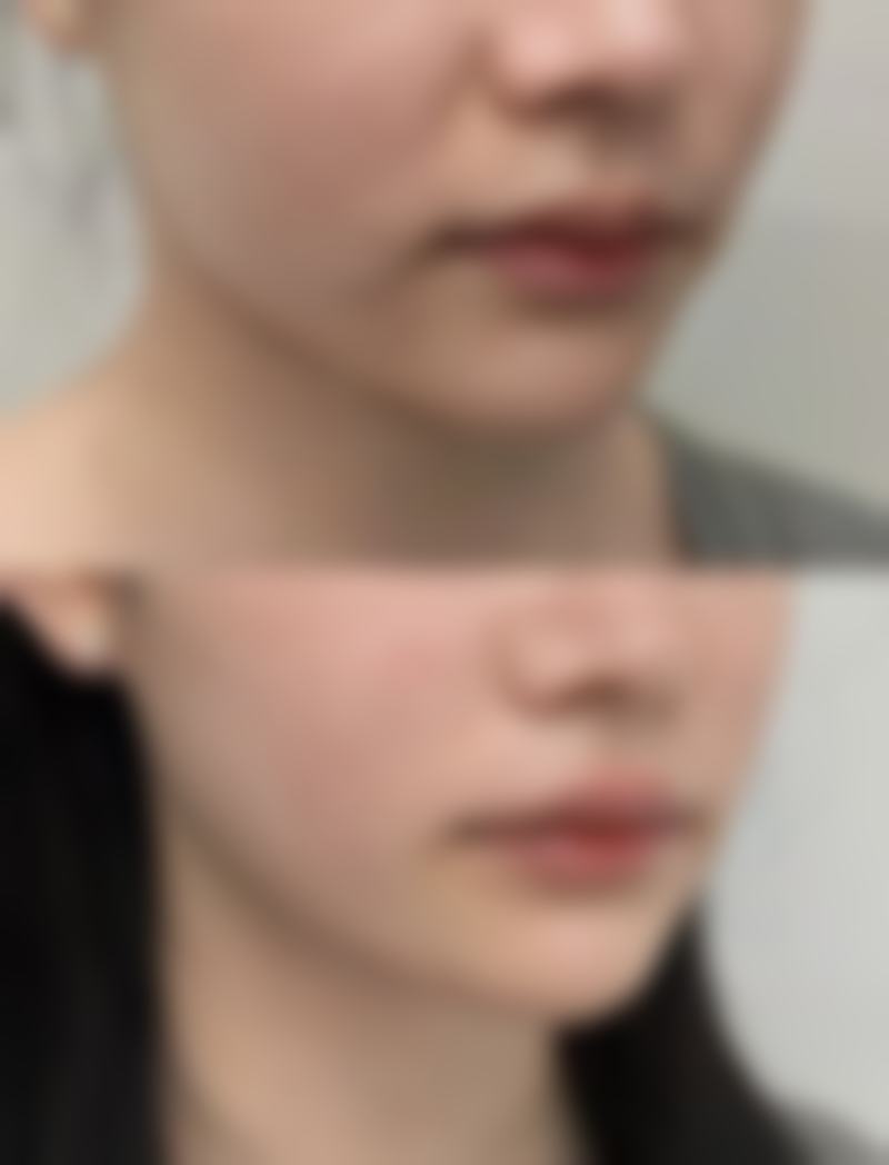 七、衡阳鑫雅韩医疗美容门诊部价格表：（仅供参考）