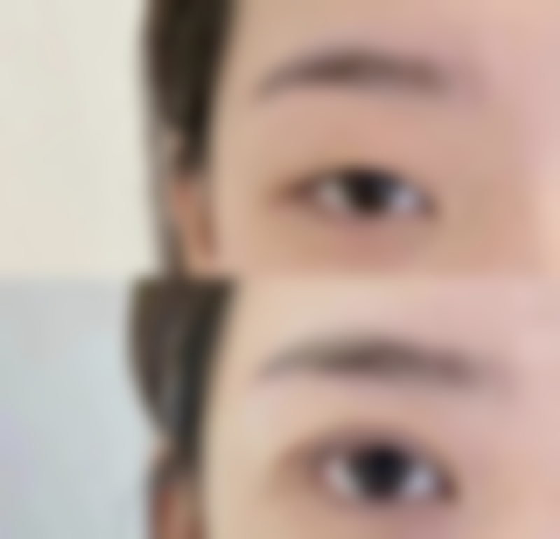 七、韩国本杰明皮肤科价格表：（仅供参考）