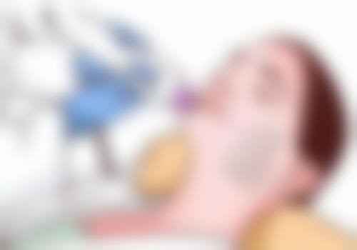 缝针伤口告别疤痕之使用抗疤产品